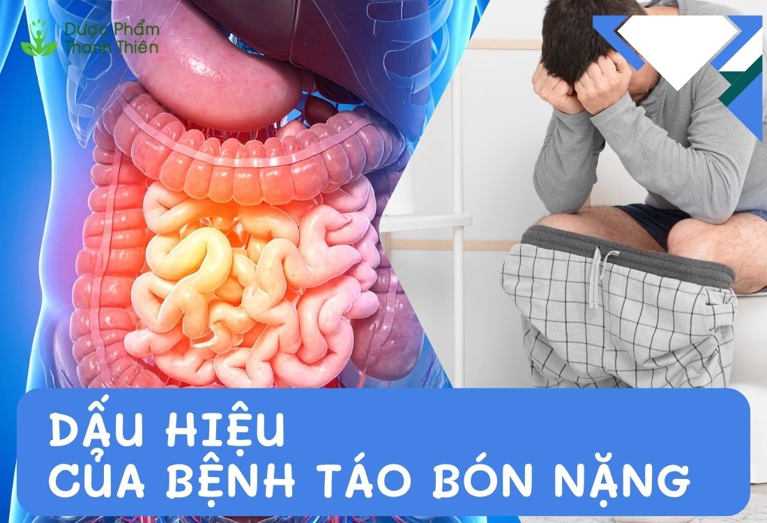 Dấu hiệu của bệnh táo bón nặng